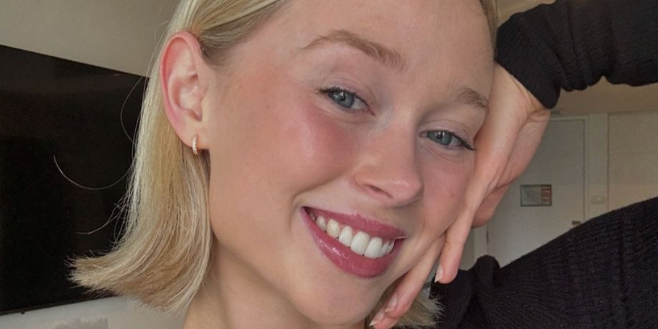 How To Fix An Overbite