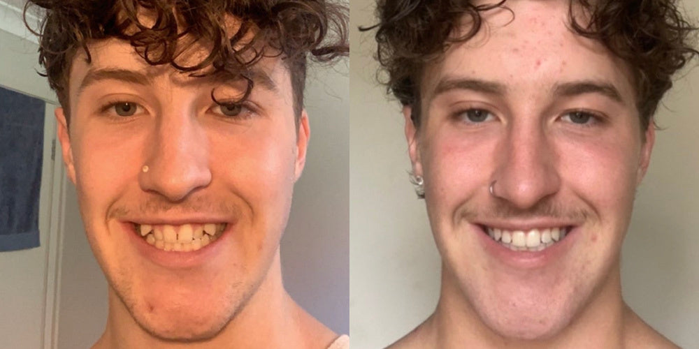 New Year, New Smile | Here's How